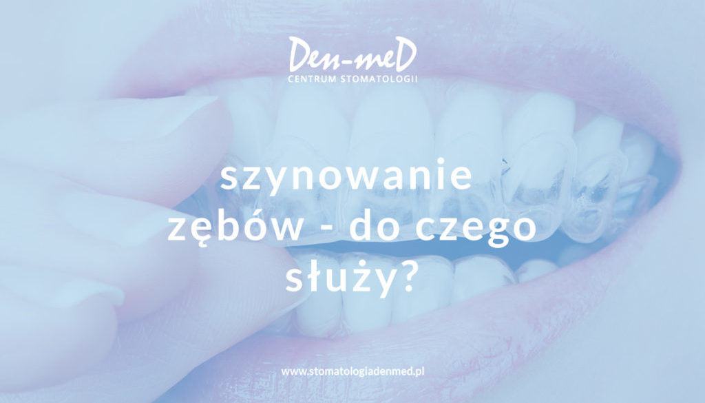 szynowanie zębów
