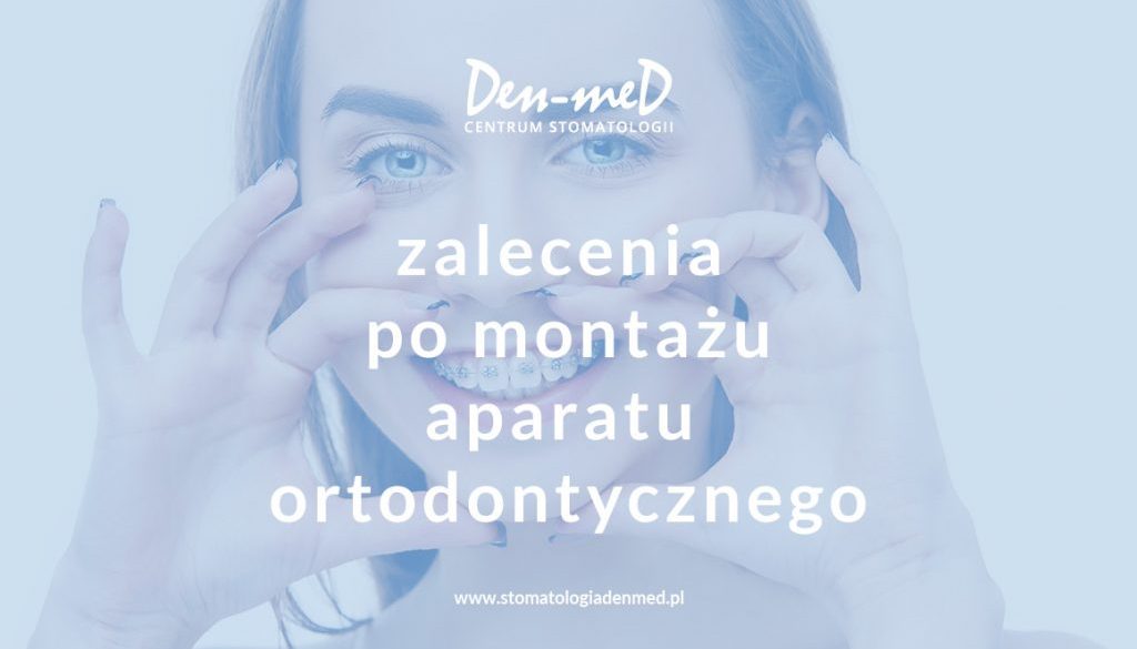 zalecenia po montażu aparatu ortodontycznego