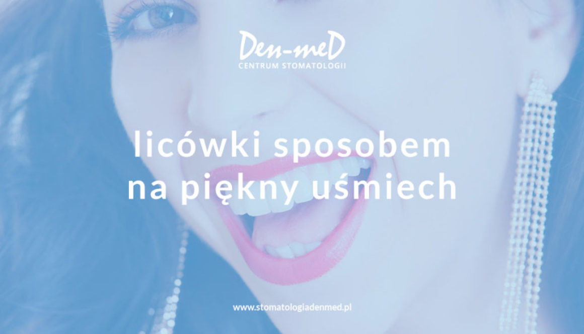 licówki sposobem na piękny uśmiech