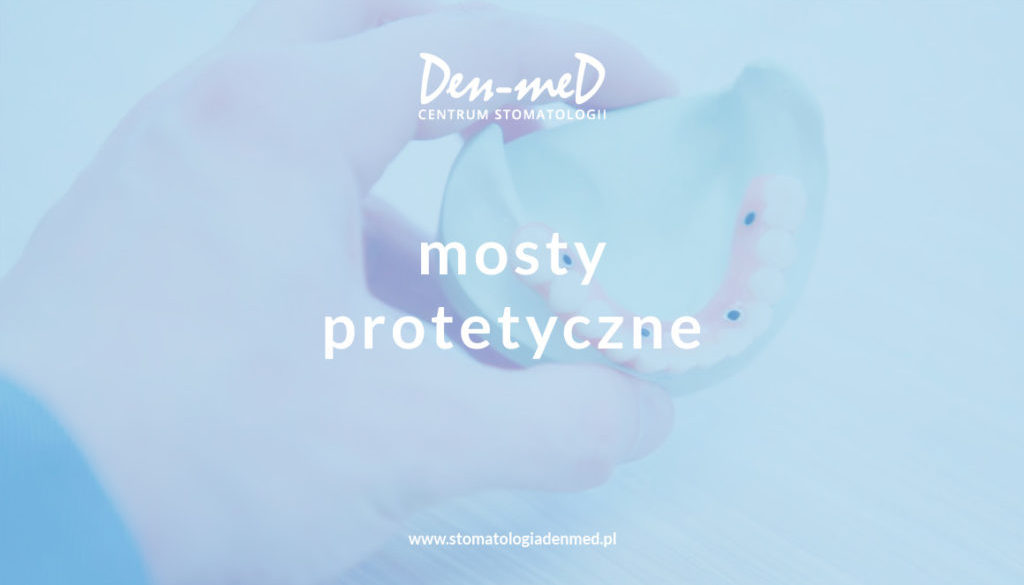 mosty protetyczne
