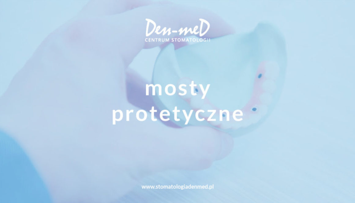 mosty protetyczne