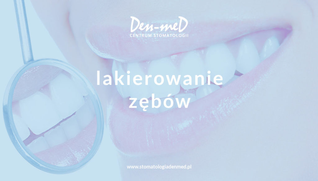 lakierowanie zębów