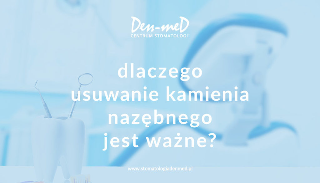 usuwanie kamienia nazębnego