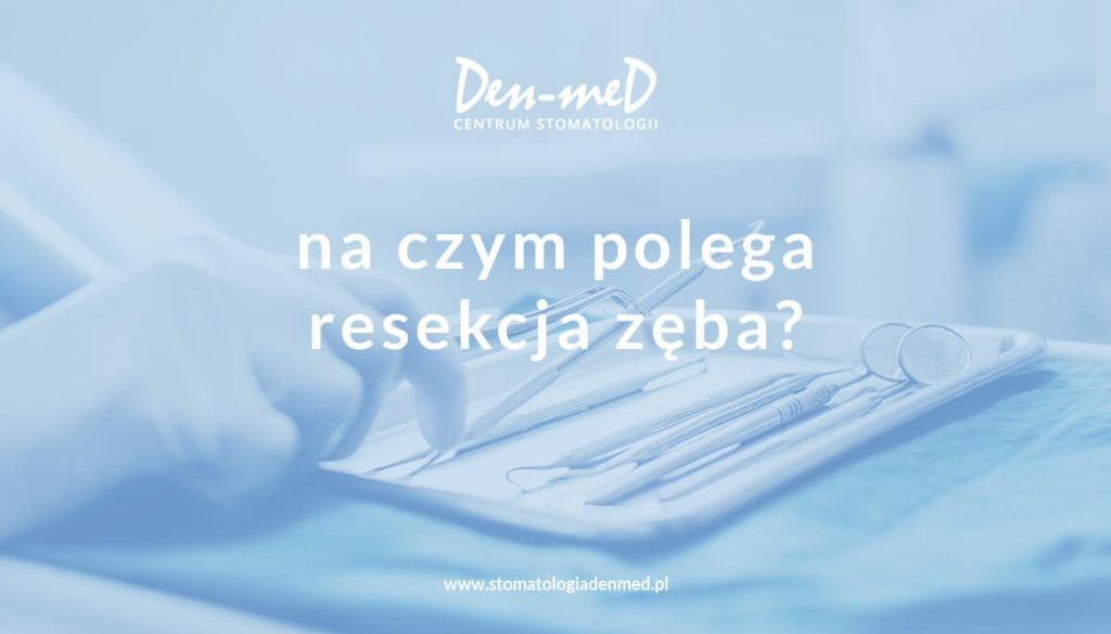 resekcja zęba