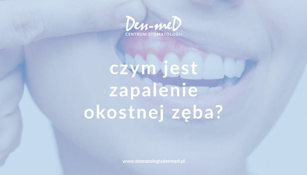 zapalenie okostnej zęba