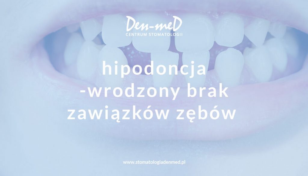 hipodoncja