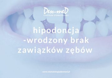 hipodoncja