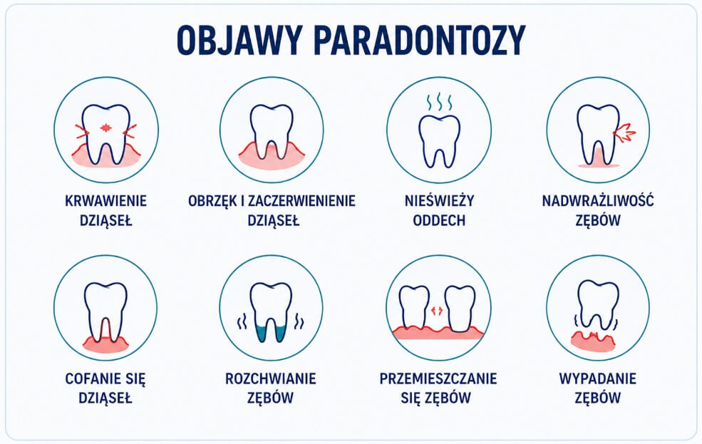 Pierwsze objawy paradontozy - jak ich nie przegapić?