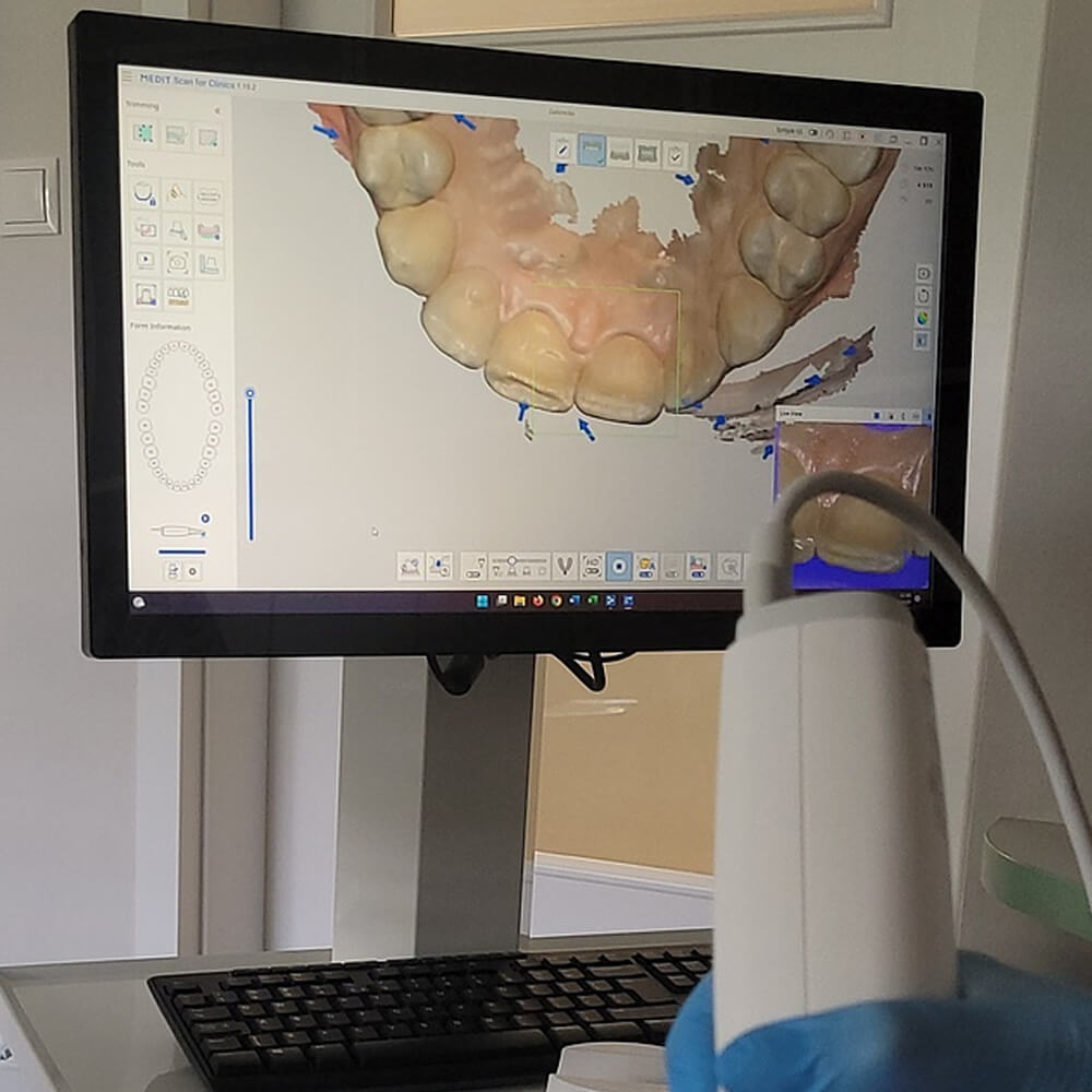 automatyczny system czyszczenia