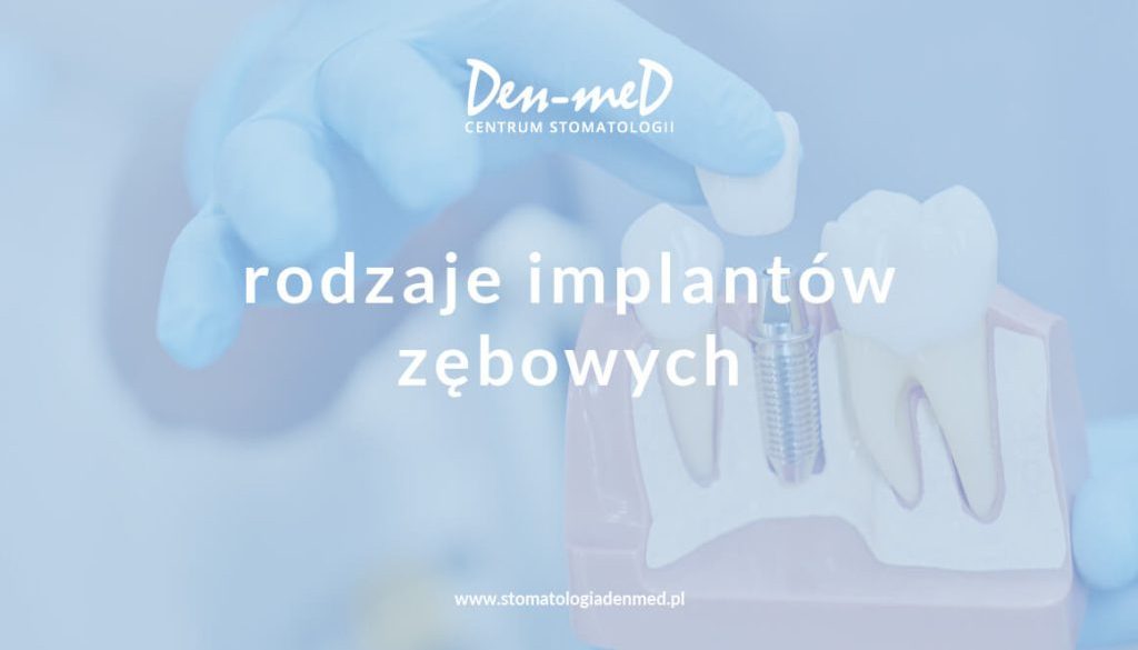 rodzaje implantów zębowych