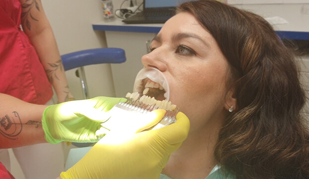 wybielanie zębów zielona góra