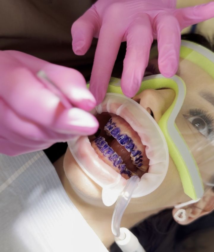 higienizacja-zebow-1 higienizacja zębów zielona góra